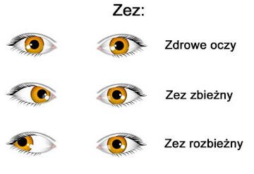 okulista łódź